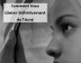 Comment Vous Lib�rer D�finitivement de l?Acn�